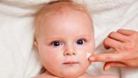 Причины шелушения кожи у новорожденного Ребенку 2 месяца шелушится кожа на лице